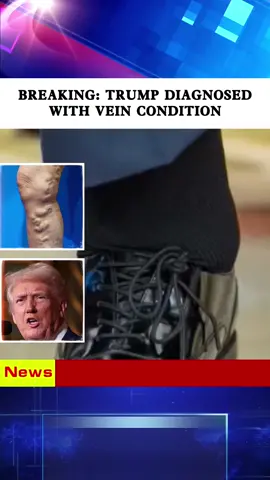 Breaking trump diagnosed with vein condition#foryou #news #usa #tiktok #fyp 