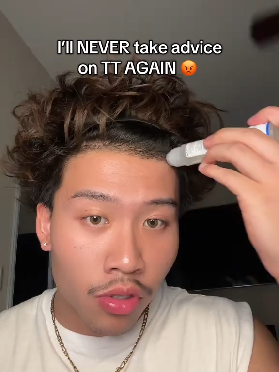 #hairline #hairgrowth #mens