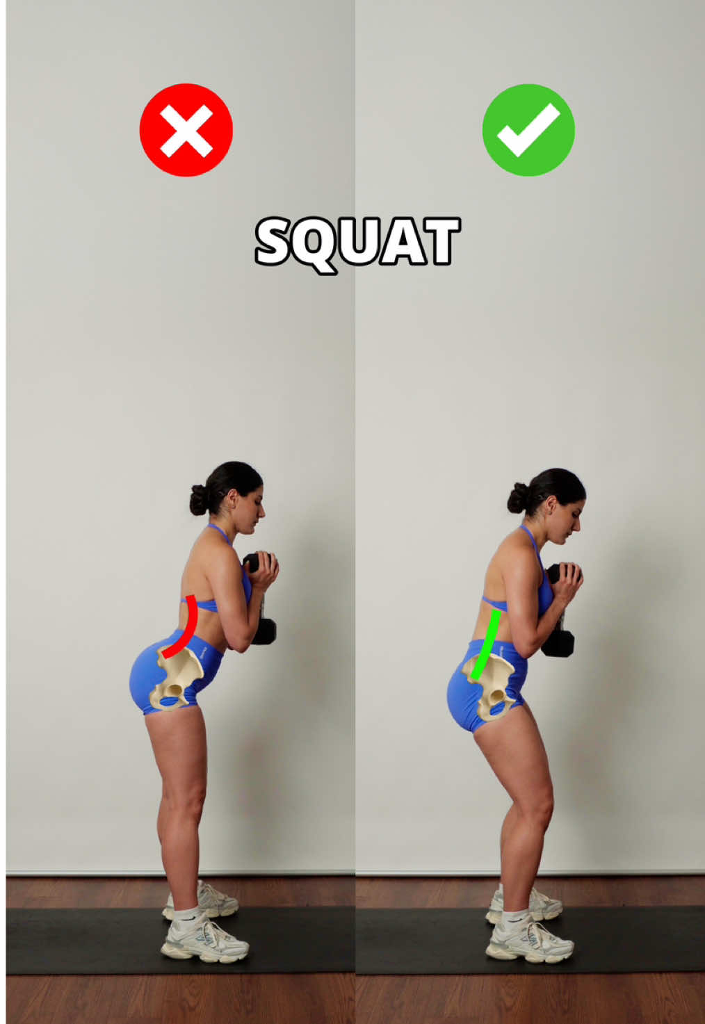 ❌ Squats giving you lower back pain? The issue might not be your back. It could be how your pelvis is positioned. Tilting your pelvis too far forward (arching your lower back) can overload the spine instead of letting your legs and glutes do the work. Keep a neutral pelvis and focus on using your quads and glutes throughout the movement. This small adjustment can make your squat feel better, safer, and way more effective. A great tip to level up your glute workout and avoid common mistakes on leg day, whether you’re at the gym or doing a home workout. Control the movement, brace your core, and move with intention. Keep this squat tip for your next lower body session. #gluteworkout #gymtips #fyp #squat #Fitness
