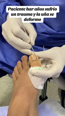 #podologia #uñas #salud #sangre #pies 