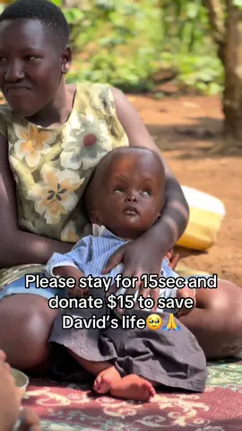 Link in bio to help🥹🙏 #allanfoundation #disability #fypppppppppppppppp #viralvedios #viral_vedio #sickbaby #baby #godislove 