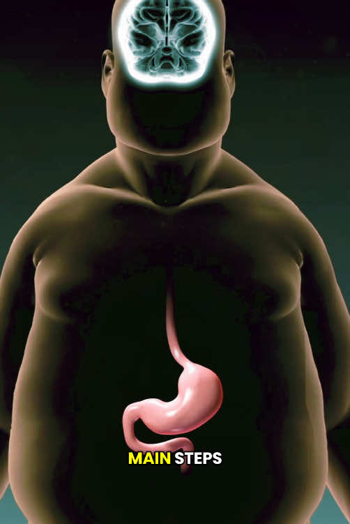 Gastric Bypass Surgery (3D Animation) #gastricbypass #gastricbypassjourney #stomachsurgery #gastricsurgery #gastricsleevesurgery #weightloss #weightlosssurgery #weightlossjouney #medical3danimation #3dmedicalanimation #bariatricsurgery #abdominalsurgeries #stomachbypass