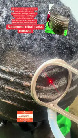 #viral #trending #trendingvideo #kampala_uganda🇺🇬🇺🇬🤝 #foryoupage❤️❤️ #viral_video #alienskinug😂🔥🔥 #foryou 