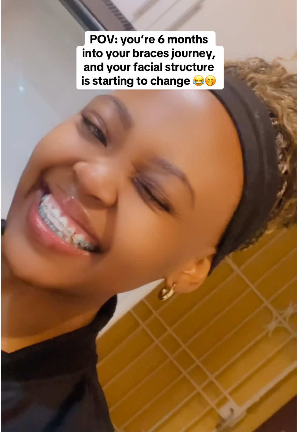 grateful for this journey, always 🥰 #braces  #dental  #fyp  #4upageシ  #tiktoksouthafrica 