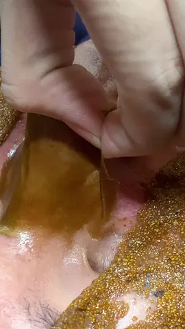 Mlem#chamsocdamun#chamsocdanam#chamsocdaseo#lequynhspa#hocnghespa#nanmunbangtay#nanmunbangtambong 