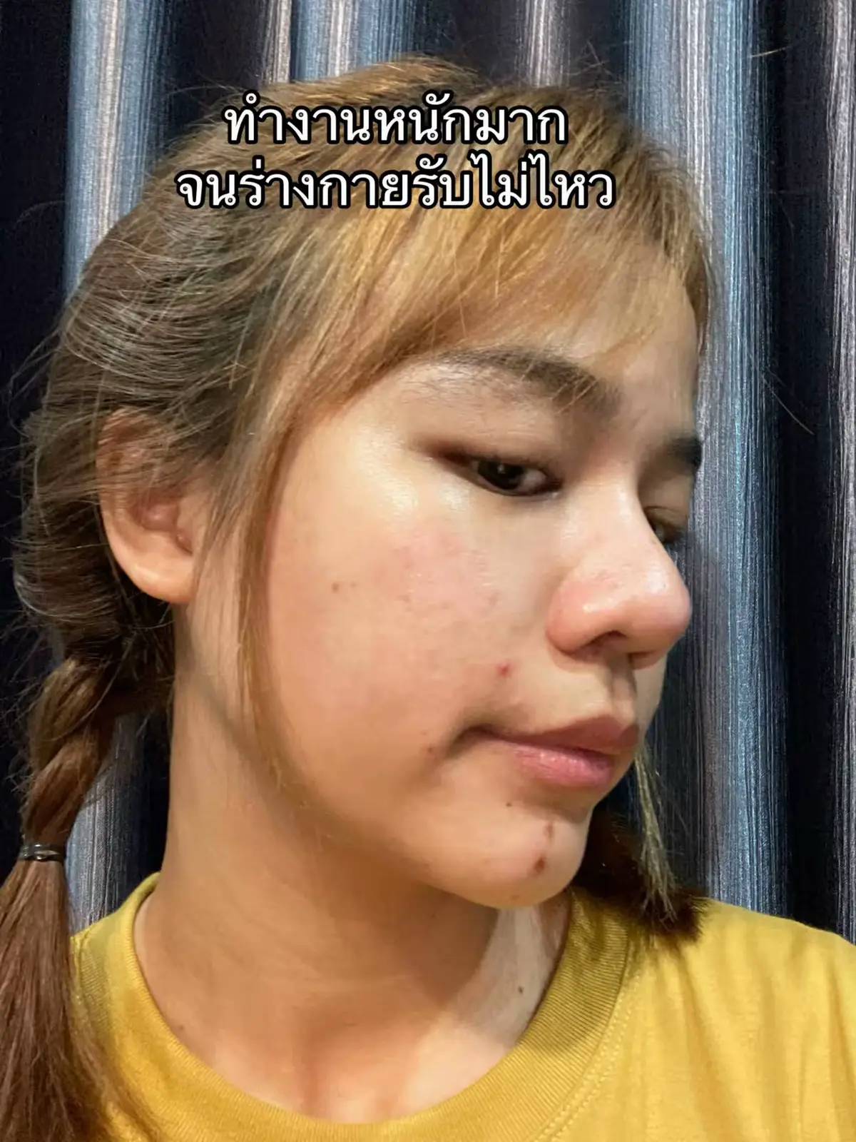 สู้มาก🥹   