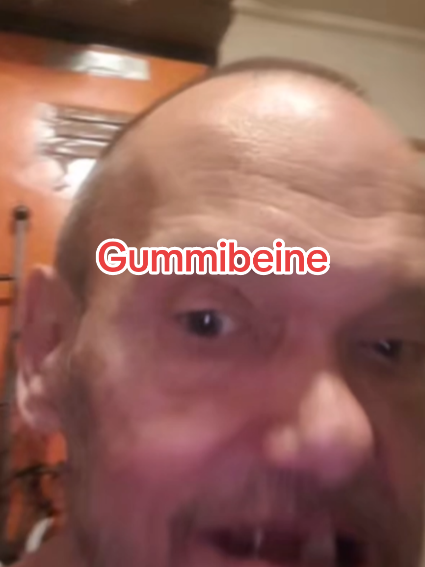 Kopfnuss Kalli zeigt seine Gummibeine ♿ #drachenlanze #kopfnusskalli #beine #rollstuhl 