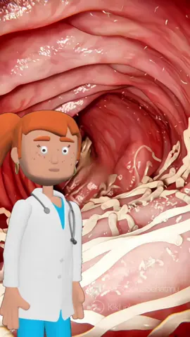 10 Tanda tubuh penuh Parasit? follow @klinik.solusisehatmu untuk info lain seputar tubuh kamu. #parasit #cacing 