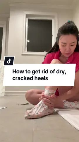 I am now ready for our vacation! It was peeling off in sheets… I used this @VT Cosmetics US Foot Mask before our Europe trip and it did not disappoint! My feet are so smooth!! And my once dry, cracked heels look amazing. Love.  #pedicurekit #pedicuretools #footmask #kbeauty #koreanbeauty 