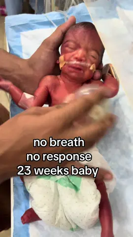 delay cry#23 weeks baby #newborn #unitedkingdom🇬🇧 #germany🇩🇪 #usa🇺🇸 
