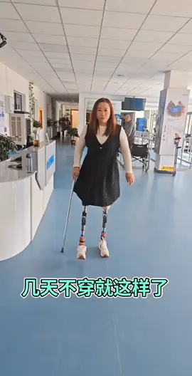Beryl DAK amputee walking on prosthetics: www.amputeeclub.com #amputee #asian #disabled #dak #dakamputee #legless #nolegs #nolegsnolimits #prostheticlegs #devotee 