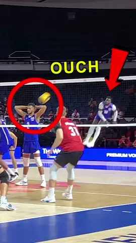Who said volleyball isn’t dangerous??  Anyone else get hit in the head with a serve? #vnl #volleyballproblems #volleyballworld #volleyballplayer 