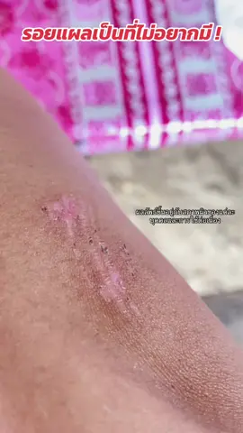 #รอยแผลเป็น #แผลนูน #รอยดำ #เจลลดรอยแผลเป็น #ครีมลดรอย #เจลสมานผิวbebetter 