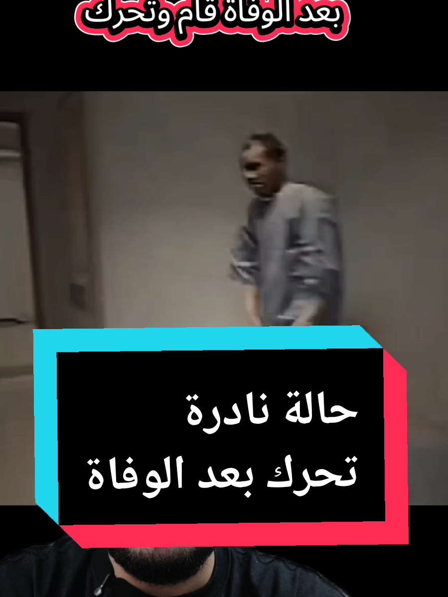في حالة نادرة بعد الوفاة  قام واتحرك سلوم العراقي #سلوم_العراقي  #وفاة #يقظة_الموت #حالة_نادرة #ترند #اكسبلور  #trend #explore 