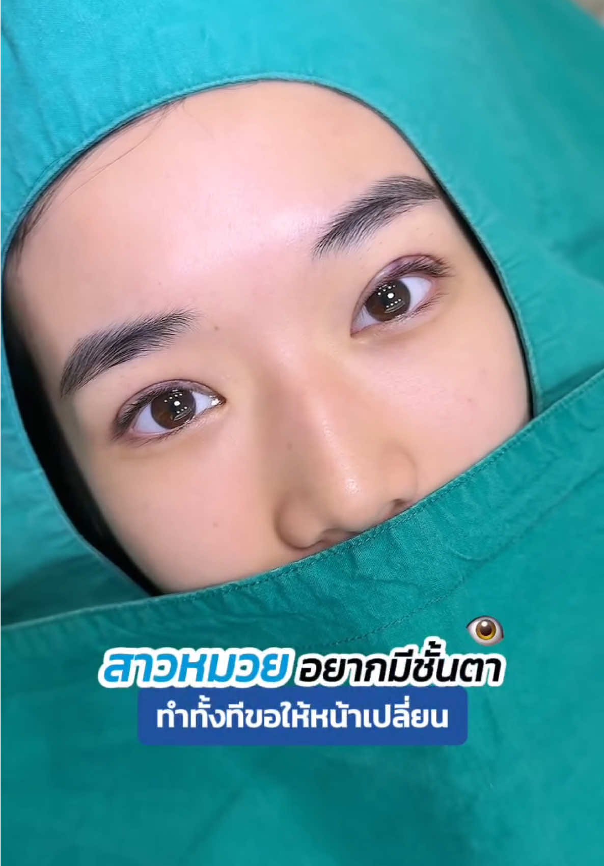 สาวหมวยอยากมีชั้นตา  ทำทั้งทีขอหน้าเปลี่ยน ##รีวิวตาสองชั้น##หมอสกาย##จักษุแพทย์##skyclinic##ทำตาที่ไหนดี##ศัลยกรรมตา##สกายคลินิก
