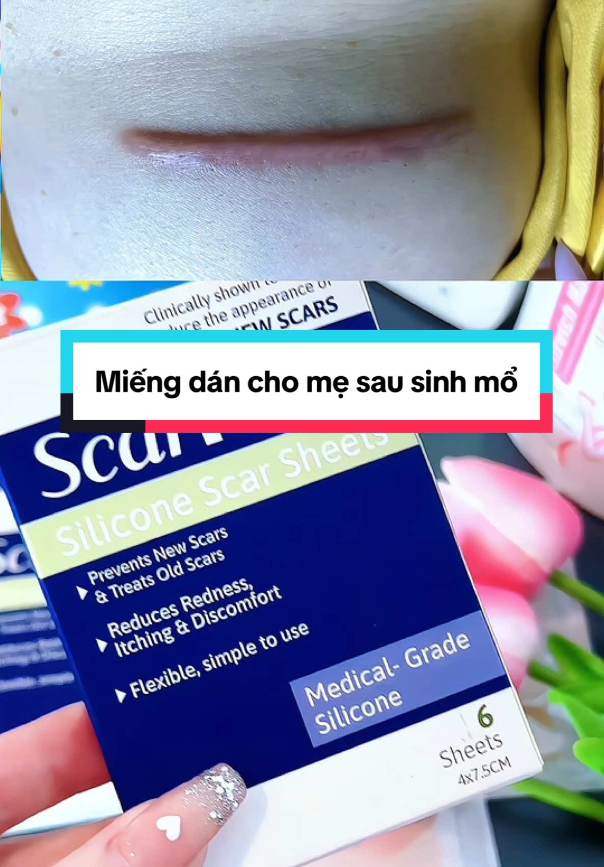 Miếng dán chân ái các mẹ kiên trừ sử dụng nha @Mẹ Thỏ Daily #miengdansilicone #seoloi #seo #sausinh #xuhuong #xuhuongtiktok m