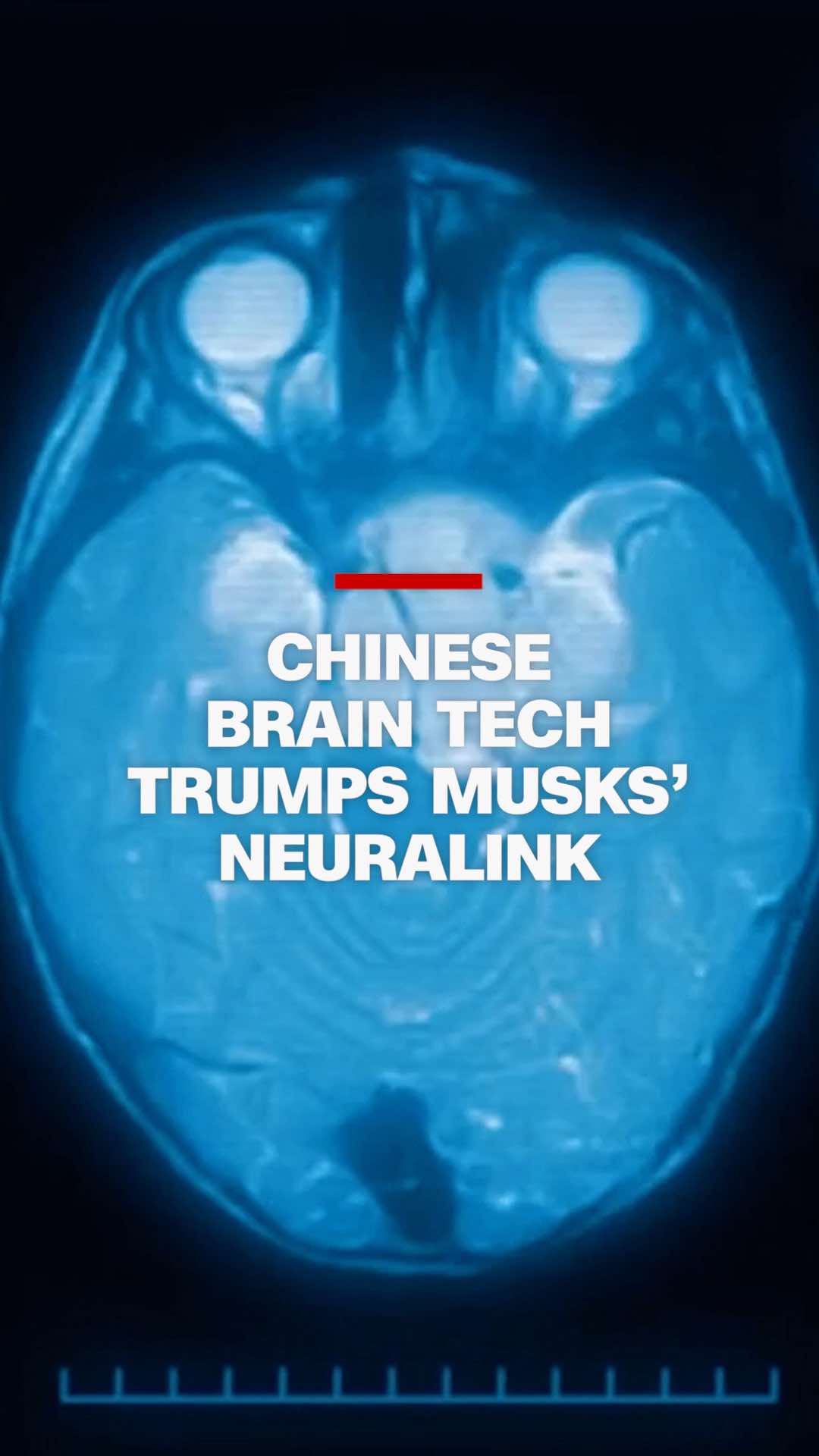 CNN gains rare access to a brain research lab in Beijing, where scientists are working to improve brain technology. Western experts say that while breakthroughs have traditionally been led in the US, China has the edge on commercializing these technologies. CNN's Kristie Lu Stout reports. #cnn #news #china #neuralink #musk #braintechnology