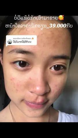 ตอบกลับ @🔥 😍🫶🏻#ພ້ອມສົ່ງ🛍️ #ຕົວແທນberrycream🍒 