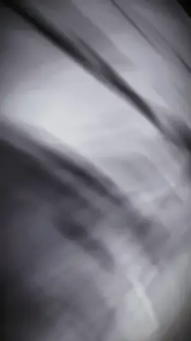 aw ảnh thật sự rất thương em của ảnhhhhhh 🥹 #joker #jokerwindbreaker #windbreaker #xh #xuhuong 