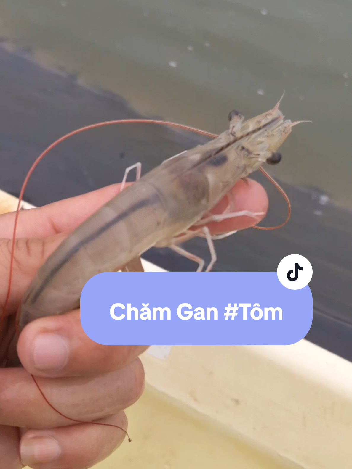 #nuoitom Methionine là một axit amin thiết yếu cho tôm, đặc biệt quan trọng trong việc hỗ trợ chức năng gan và giải độc gan. Việc bổ sung methionine vào thức ăn cho tôm giúp cải thiện quá trình chuyển hóa, tăng cường khả năng loại bỏ độc tố, giảm stress môi trường và duy trì sức khỏe gan tụy, từ đó giúp tôm phát triển tốt hơn. Chi tiết: Vai trò của Methionine trong gan tôm: Gan là cơ quan quan trọng trong việc chuyển hóa thức ăn và loại bỏ các chất độc hại của tôm. Methionine, một axit amin, đóng vai trò quan trọng trong quá trình này, đặc biệt trong việc giải độc gan và duy trì chức năng gan khỏe mạnh.  Tăng cường chức năng gan: Bổ sung methionine giúp gan tôm hoạt động hiệu quả hơn, giúp tôm loại bỏ các chất độc như độc tố nấm mốc, kháng sinh, và các chất thải từ quá trình trao đổi chất.  Giảm stress và duy trì ổn định môi trường: Trong môi trường nuôi thâm canh, tôm thường xuyên chịu áp lực từ mật độ nuôi cao và thay đổi môi trường. Methionine giúp tôm giảm stress và duy trì sự ổn định nội môi, từ đó tăng cường sức đề kháng và khả năng chống chịu bệnh tật.  Cải thiện tăng trưởng và tỷ lệ sống: Khi gan tôm khỏe mạnh, tôm sẽ hấp thụ thức ăn tốt hơn, tăng trưởng nhanh hơn và có tỷ lệ sống cao hơn.  Các dạng methionine sử dụng trong nuôi tôm: Có nhiều dạng methionine được sử dụng trong nuôi tôm, bao gồm L-methionine, DL-methionine, và MHA-Ca.  Lưu ý khi sử dụng: Cần chú ý đến liều lượng methionine phù hợp với từng giai đoạn phát triển và loại tôm cụ thể, cũng như kết hợp với các chất bổ sung khác như men tiêu hóa, vitamin, và khoáng chất để đạt hiệu quả tốt nhất. #duongsonghau #tomthechantrang #nuoitomaodat 