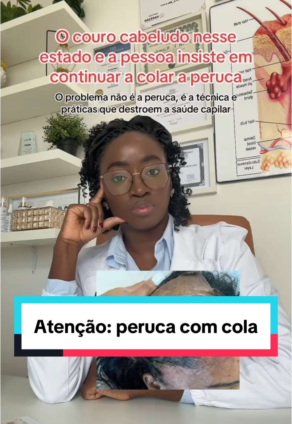 🌻Não, por favor não 🙌🏾 #saudecapilar #dinamoreiratricologista #tricologistaangolana #jornadacapilar #tricologiaangola #terapiacapilarangola #fyp 