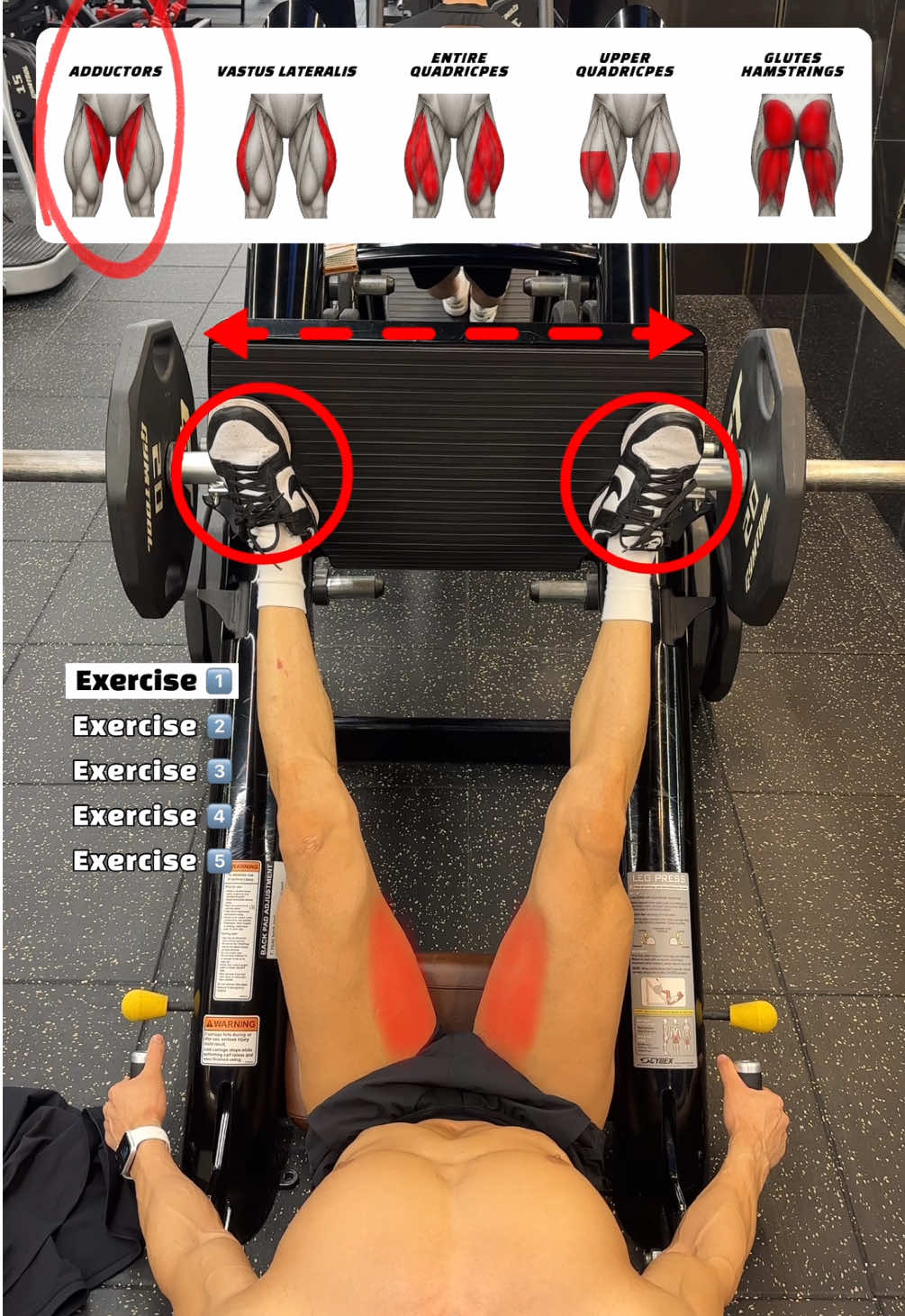 🔽 파워 레그 프레스 다리 위치별 자극 차이 🔽 🔸Power Leg Press Foot Placement Variations – Muscle Focus🔥 1. 넓게 (Wide Stance) - 발을 어깨보다 넓게 두고 수행하면 허벅지 안쪽(Adductors)에 자극이 집중되어 내전근을 강화하는 데 효과적입니다. 2. 좁게 (Narrow Stance) - 발을 좁게 모아서 수행하면 대퇴사두근 외측광근(Vastus Lateralis)에 자극이 집중되어 허벅지 바깥쪽 볼륨을 키우는 데 좋습니다. 3. 기본 (Shoulder-Width Stance) - 어깨너비로 발을 두고 수행하면 대퇴사두근 전체(Entire Quadriceps) 전체를 균형 있게 자극하여 전체적인 하체 발달에 안정적인 효과를 줍니다. 4. 좁고 아래쪽 (Low & Narrow Stance) - 발을 아래쪽에 좁게 두고 밀면 무릎 굽힘이 강조되어 대퇴사두근 상부(Upper Quadriceps)에 자극이 집중되어 허벅지 앞쪽을 집중 공략할 수 있습니다. 5. 좁고 위쪽 (High & Narrow Stance) - 발을 위쪽에 좁게 두고 수행하면 햄스트링(Hamstrings)과 엉덩이(Glutes)에 자극이 들어가 허벅지 뒤쪽과 둔근 단련에 효과적입니다. #legday #legpress #quadsworkout #legs #오운완 #fitnesstips 