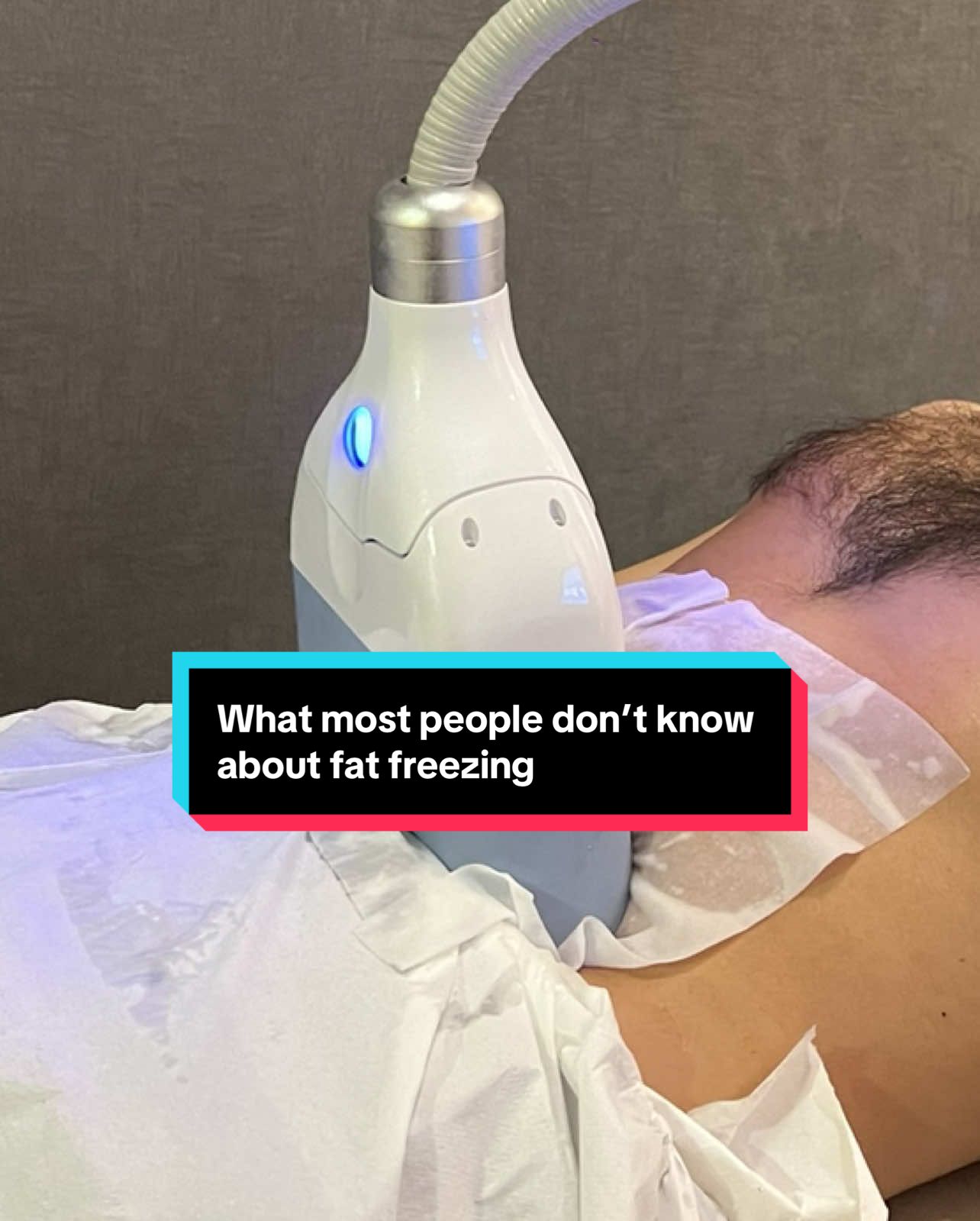 Thinking about CoolSculpting? Here’s the stuff they don’t put in the fat freezing brochure… 👀❄️ #coolsculpting #bodygoals #fatfreezing #cryolipolysis #fatloss 