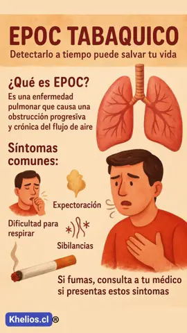 EPOC Tabaquico: Detectarlo a Tiempo Puede Salvar Tu Vida El EPOC (Enfermedad Pulmonar Obstructiva Crónica) es una afección respiratoria progresiva que se asocia principalmente al consumo de tabaco. Esta infografía destaca los síntomas más comunes como dificultad para respirar, expectoración y sibilancias, y hace un llamado a consultar al médico si se presentan estos signos, especialmente en personas fumadoras. #EPOC #EPOCTabaquico #SaludPulmonar #DejaElCigarro #RespiraMejor #ConsultaTemprana #Tabaquismo #CuidadoRespiratorio #VidaSinHumo