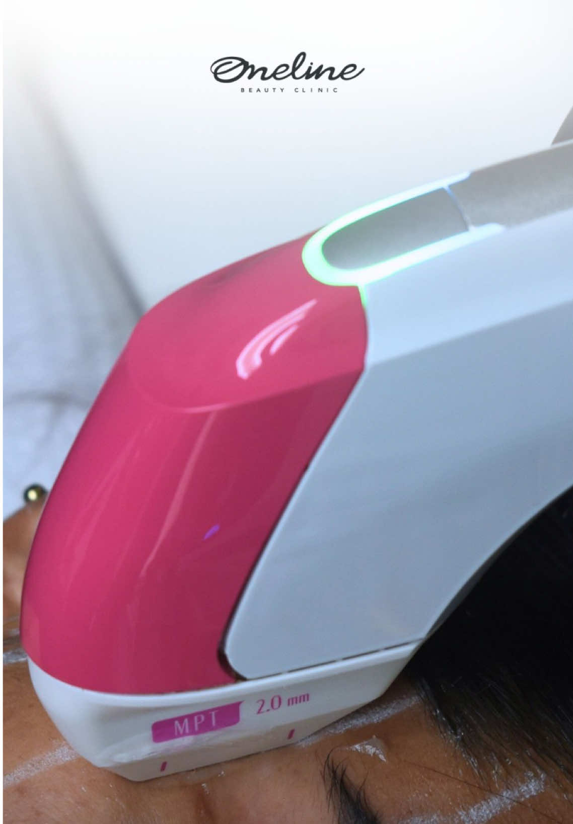 ¿Sabes cómo funciona Ultraformer MPT y por qué todos hablan de él? 🔍 Mira por qué este tratamiento se considera una buena opción para quienes buscan un efecto lifting de forma progresiva y sin cirugía. #UltraformerMPT #TratamientoEstético #TecnologíaAvanzada #RejuvenecimientoNoInvasivo #PielFirme #cuidadofacial #fyp 