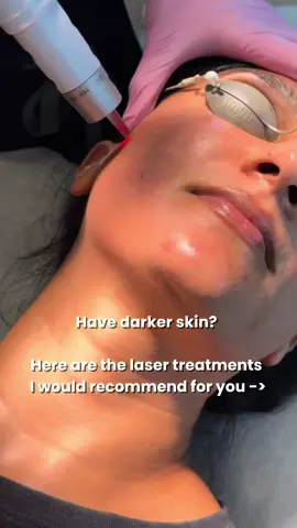 Just to name a few! The most important thing is the provider. Make sure they know how to treat darker skin.  #lasertreatment #darkskin #halolaser #picolaser #dermtok 