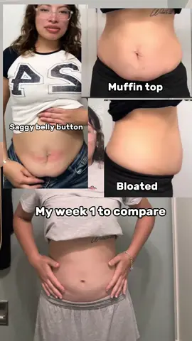 Ughh my camera doesn’t do me any justice 😭 does anyone else get bad quality from using CapCut? #CapCut #fyp #mompouch #strechmarks #looseskin #postpartumbody 