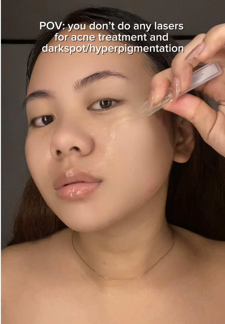 been using this for almost a month and here’s my review about this  #jmcyxteashell #teashellacneserum