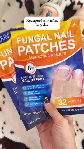Arregla las uñas feas mientras duermes - estos parches me salvaron🦶🦶 #NailTok #HYourNalls #FungalNailSolution #AmazonMustHaves #tiktokmademebuyit #SkincareButForNails #NailTransformation #beforeafter #SelfCareTools #foot #HealthyNailsJourney #OvernightFix #byeuglynails #TikTokShopLastChance #TikTokShopNewYearNewAura #tiktokshopholidayhaul #spotlightfinds #tiktokshoploveatfirstfind #DealDrops #SpringSale#TikTokMadeMeBuylt
