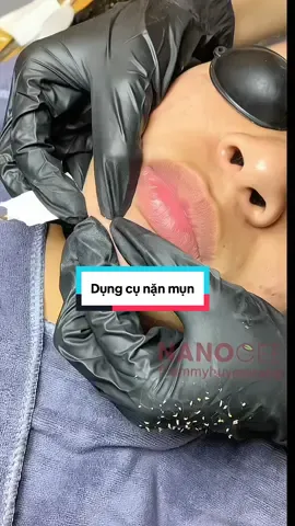 Mê nặn mụn  #thammyhuyentrang #nanocee #xuhuong #nanmun #gangtayytekhongbot #gangtaynanmun 