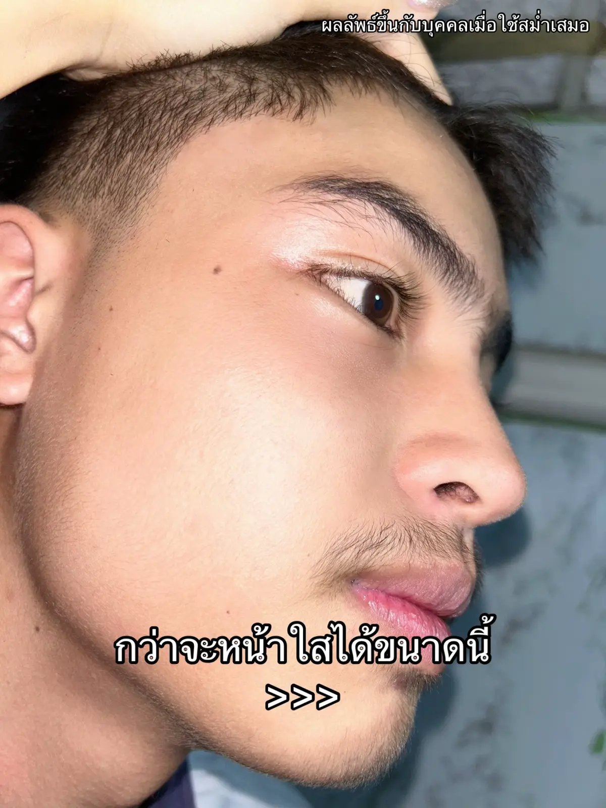 #สกินแคร์ #สมุนไพรกาญจนา #เซรั่มกาญจนา #มอยส์กาญจนา #น้องมีนสมุนไพรกาญจนา #รีวิวสกินแคร์ #ใช้ดีบอกต่อ #หน้าใส #ดูแลตัวเอง 
