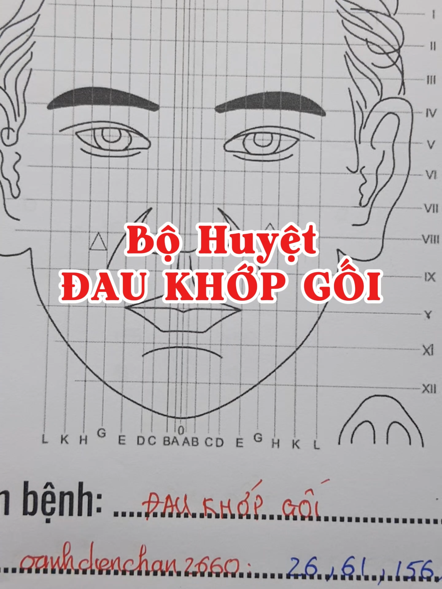 Bộ huyệt hỗ trợ ĐAU KHỚP GỐI Diện Chẩn#dienchanlade #oanhdienchan2660 #dienchanbuiquocchau #xuhuong2025 #daukhopgoi #khopgoi