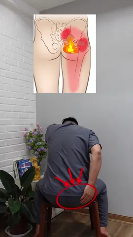 Bài tập hỗ trợ kéo giãn cơ hình lê . Hãy tập cùng Dr Hùng nhé! #vatlytrilieu #coxuongkhop #yhoccotruyen #neckpain #backpain #drtronghung #drvutronghung 