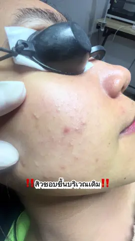 #พี่กุ้งกดสิวคลองเตย  #skinbarrier  สร้างเกราะป้องกันผิวให้แข็งแรง ควบคู่กับการใช้สกินแคร์ ที่ช่วยรักษาสิว แบบพอดี ไม่ประโคมจนมากเกินไปนะคะ 