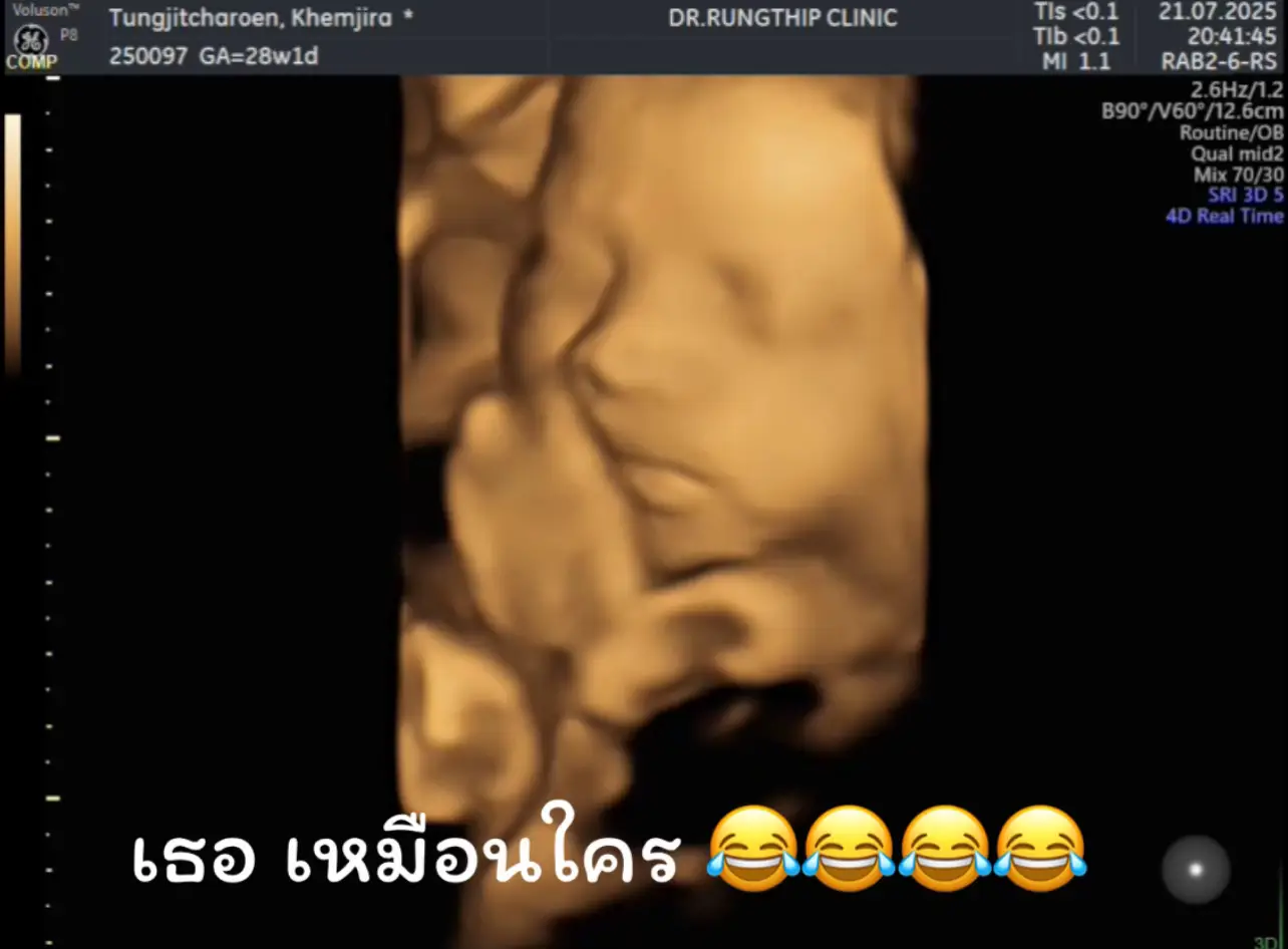 เจ้าลูกชายของแม่ #ท้องแรก 