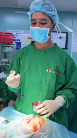 Tháo chất liệu - cấy trung bì ##drtungminh #nangmuicautruc #nangnguc #hutmo #caymotrungbi 