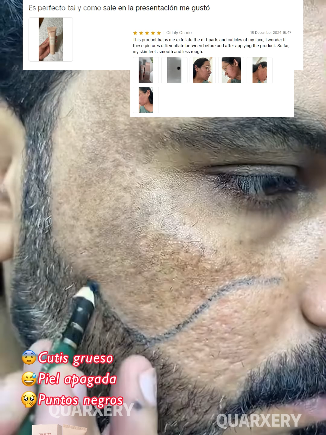¡El increíble exfoliante viral de TikTok! Elimina fácilmente las células muertas y la piel opaca, ¡incluso la piel afectada por la diabetes puede brillar! Recomendado por miles de influencers, ¡haz clic y pruébalo ahora! #moisturizing #healthyskin #diabetes #melanin #skincare #SkincareRoutine #quarxery #diamondart #diabetic #hydrafacial #Hyperpigmentation #hyperpigmentation #skincareroutine #wrinkletreatment #bodycare #Pigmentation #exfoliantingtowel #exfoliation #ance #pores
