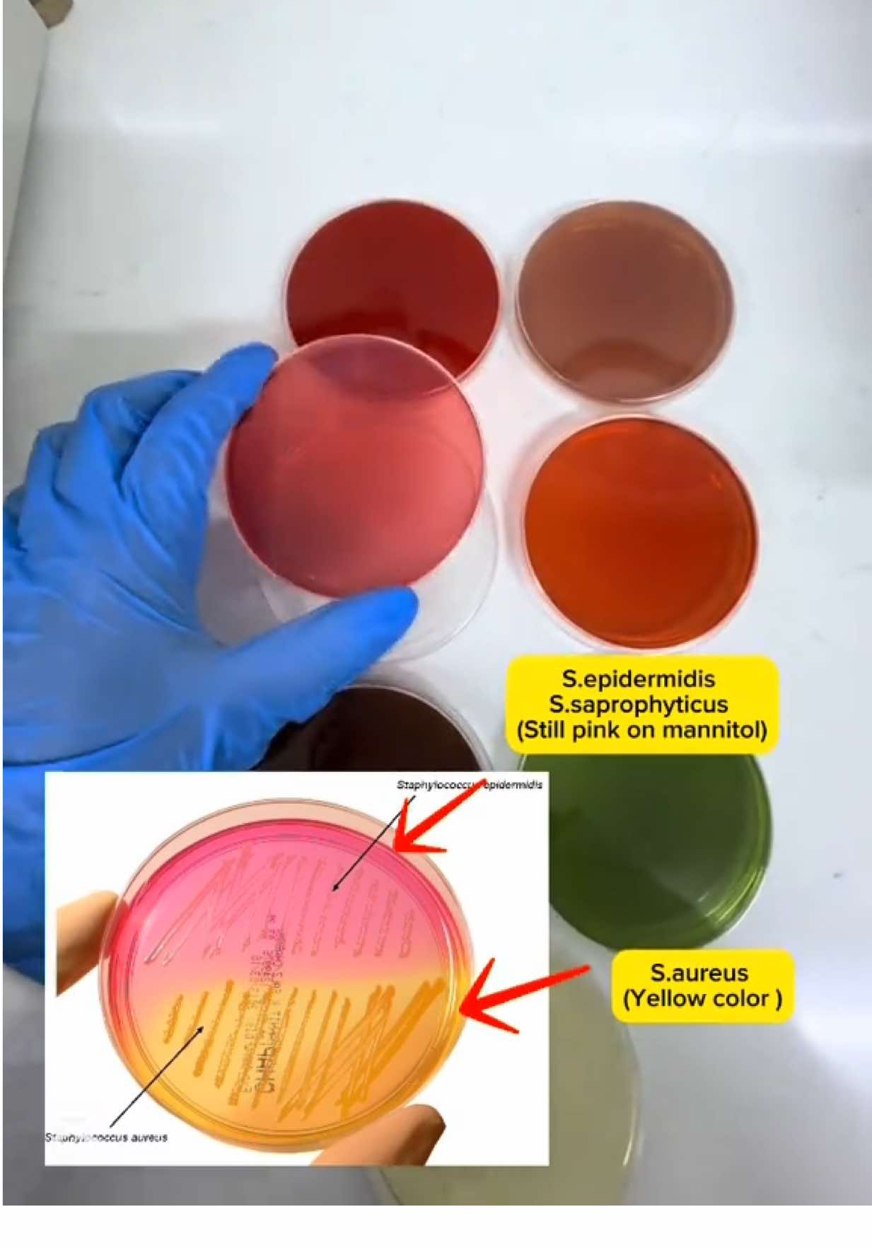 التفريق بين الاوساط الزرعية الاساسية في مختبر الاحياء المجهرية#bacteriology🔬🔬 #tiktoklongs #viralvideo #medical #foryou #tutorial #technology #explore #tiktoktrending #fyp 