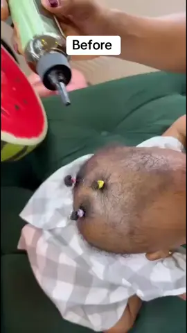 #novahairproducts1 #batanaoil #hairlinegrowth #hairgrowthproducts #fyppppppppppppppppppppppp #viral_video #trendingnow 