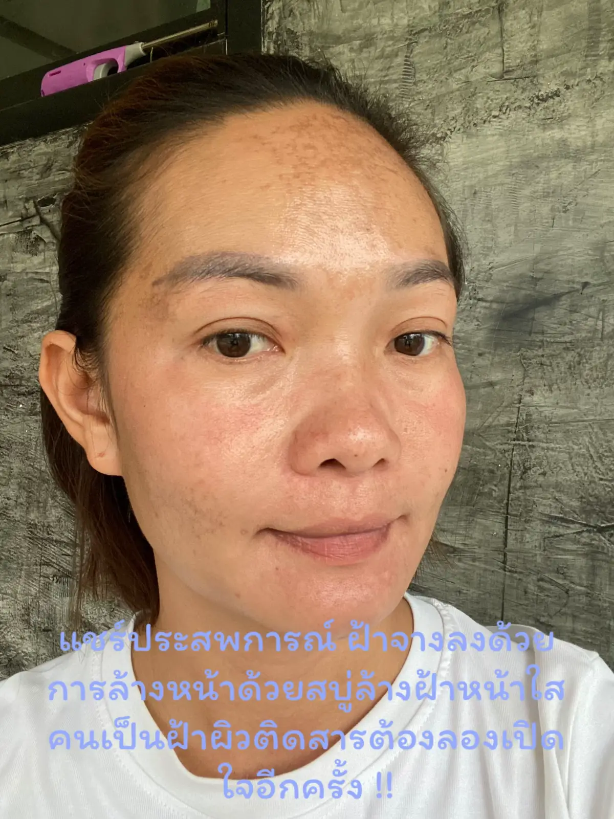 สบู่ที่คนเป็นฝ้าต้องลองใช้ ณ ตอนนี้ !#ฝ้ายจัง #ฝ้า #ผิวติดสาร 