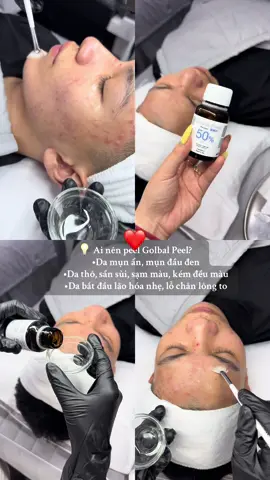 💡 Ai nên peel Golbal Peel? 	•#dượcmypham #peel_da_số_1_Hà_Đông #hà_đông #trendingtiktok #peel #chămsócdachuyênsâu #điều_trị_mụn_số1_hà_đông_ #peelda 