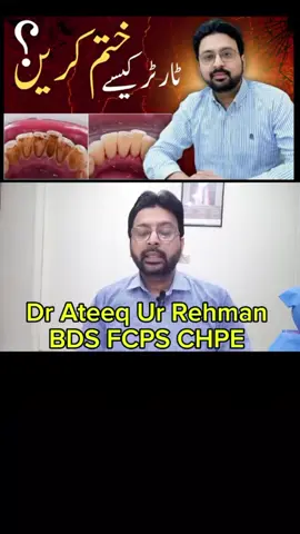 #duet with @ateeq dentist #tartar 