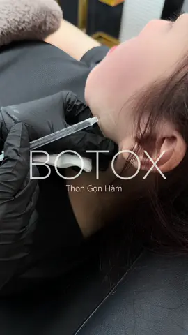 Botox best seller nhà bé #fyp #nhấnmi #thudaumot #filler 