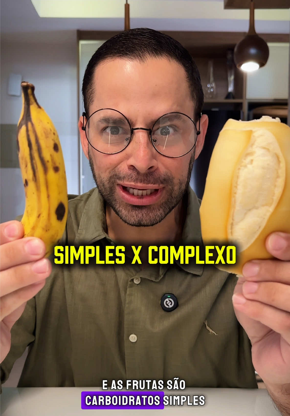 🚨 Com quantos anos você descobriu que o pão é carboidrato complexo e a fruta é carboidrato simples? 😱🥖🍌 Pois é… a maioria das pessoas (inclusive muitos profissionais 👀) ainda associa “simples” com “ruim” e coloca o pão como vilão da história. Mas o que ninguém te contou é que a classificação dos carboidratos vem da estrutura da molécula, e não do “bem ou mal” que ela faz. 🔬 Desenhando pra vocês: 🍬 Carboidratos simples = estruturas menores (como glicose e lactose) 🥦 Carboidratos complexos = estruturas maiores (como o amido e as fibras) 👉🏼 E a fruta? É carboidrato simples, sim. Mas é rica em fibras, vitaminas e minerais — ou seja, vai muito além da teoria da molécula. ⚠️ Não é sobre a classificação isolada. É sobre o contexto nutricional e o conjunto da obra. 📝 Anota aí: Se seu objetivo é saúde e emagrecimento, priorize os carboidratos integrais: 🌾 Grãos 🥕 Legumes 🥬 Verduras — alimentos que alimentam de verdade! E se seu objetivo é aprender nutrição com ciência, leveza e um toque de deboche… Segue o Nutri das Estrelas, tá amor? 🌟 #CarboidratosSimples #CarboidratoComplexo #NutriçãoDesenhada #NutriDasEstrelas #MitosDaNutrição #FrutaNãoÉVilã #ChupacabraDoPão