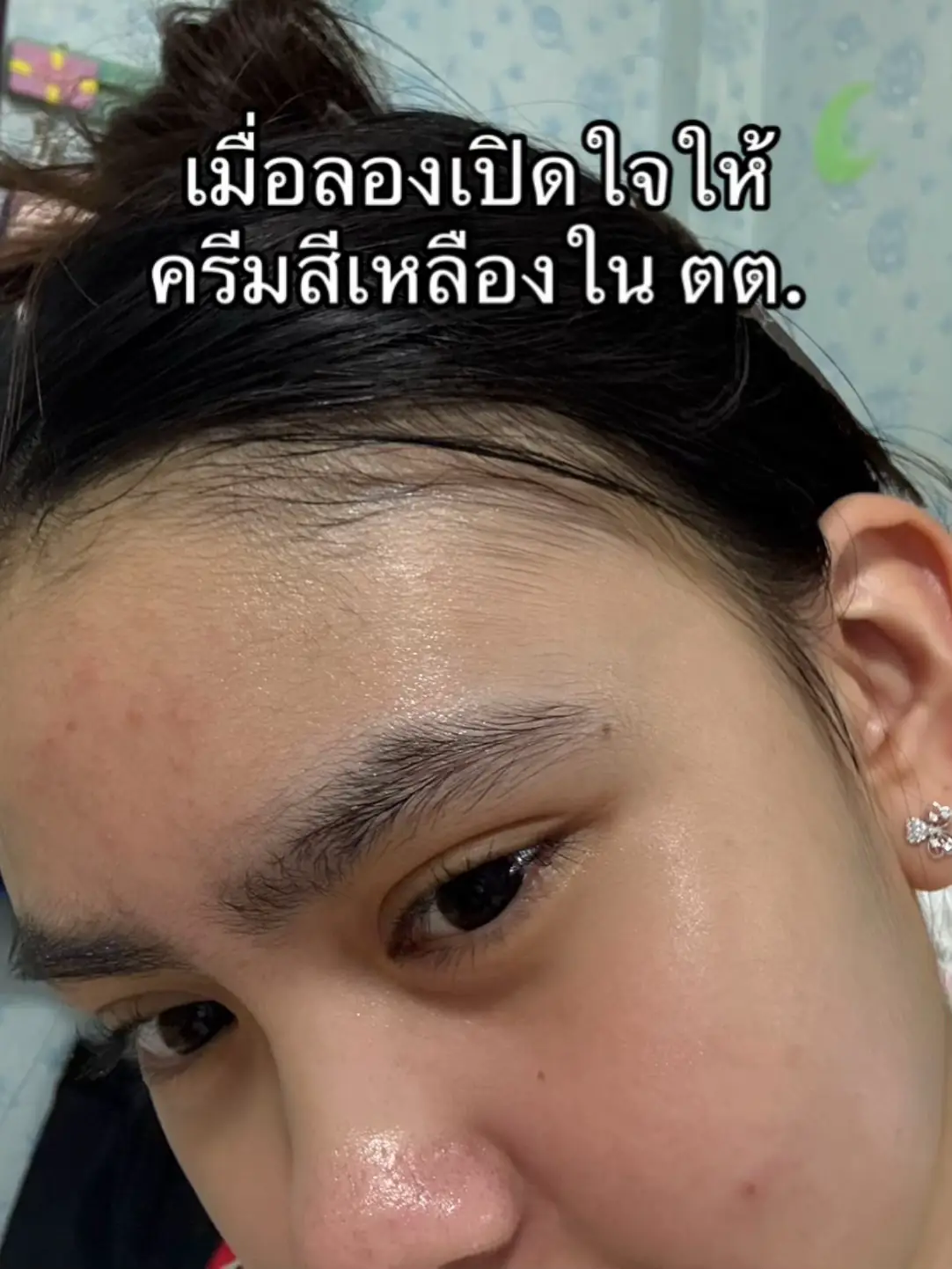 #ใช้ดีบอกต่อ #ของดีบอกต่อ #tiktokviral #tiktokป้ายยา #ลดสิว #หน้าใส #วาเบลล์ไนท์ครีม #ครีมวาเบลล์ #วาเบลล์วิตามินมะเขือเทศ #vabelleskincream 