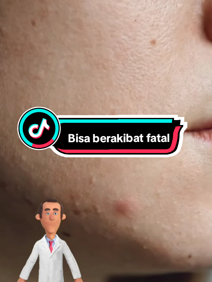 CEK DISINI BRE 👉 @ApaAja 👈 Sekali kamu pencet jerawat, kamu buka gerbang bencana. Bakteri menyebar. Kulit robek. Bekas luka bisa menetap selamanya. Yang tadinya kecil… bisa jadi peradangan besar yang susah hilang. Bisa bikin bopeng parah ‼️ Berani ambil risikonya? #info #information #edukasi #fakta #faktamenarik #faktaunik #jerawat #skincare #jerawatbatu #reels #foryou #fyp 